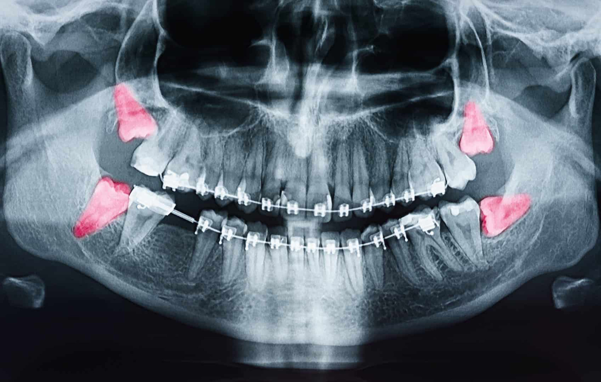 Smile 2 Shine DENTAL CLINIC