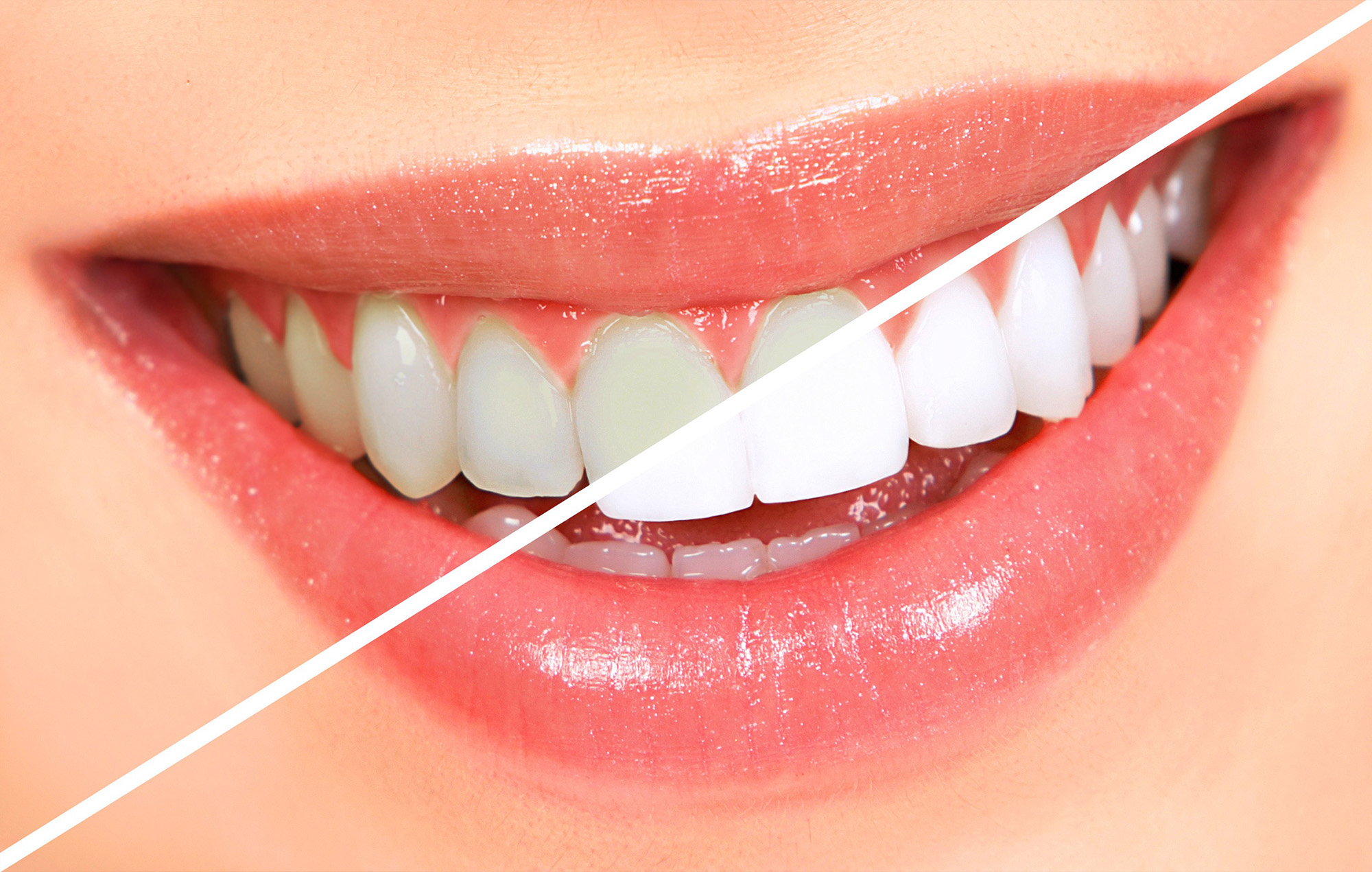 Smile 2 Shine DENTAL CLINIC
